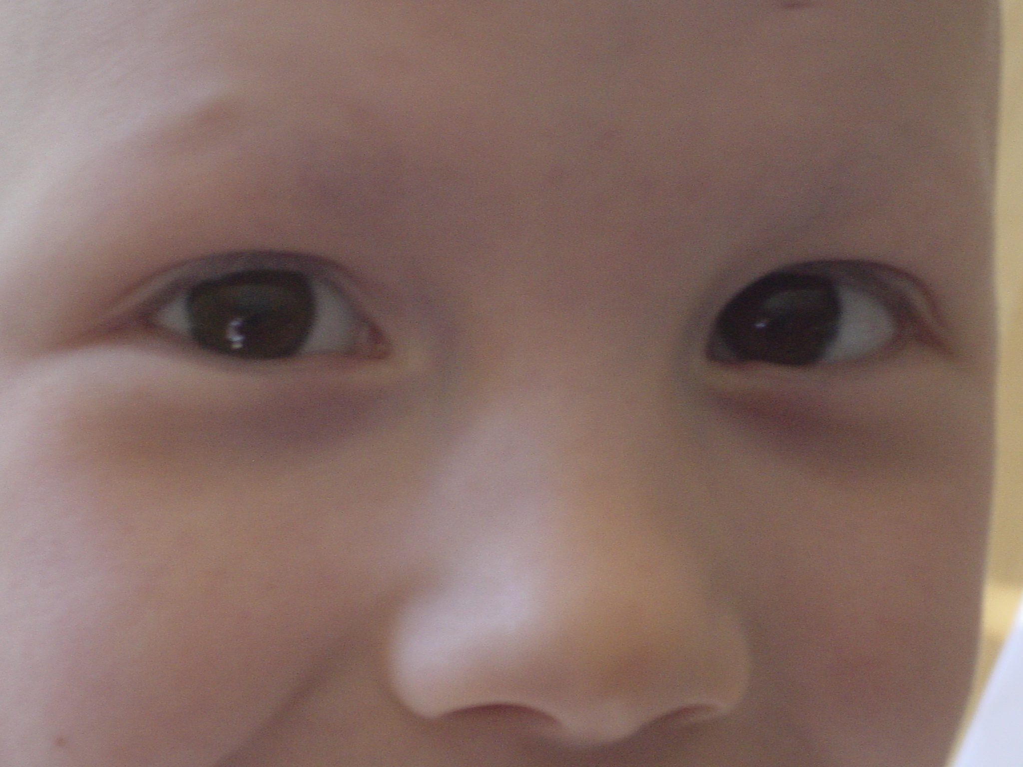 Eyelashes growing back!.jpg
